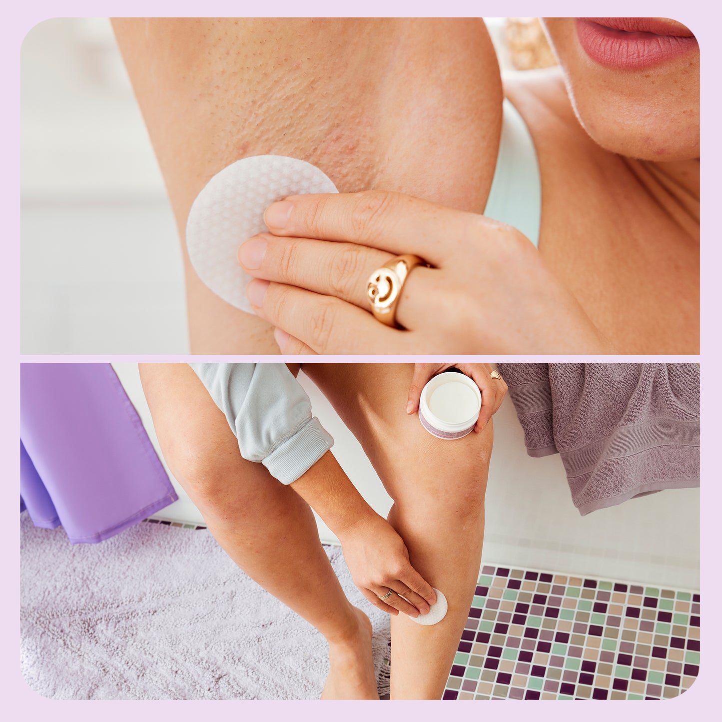 Ingrown Hair Pads frá FAB vinna gegn inngrónum hárum