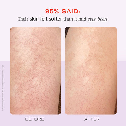 KP Bump Eraser Body Scrub 10% AHA Strawberry MINI