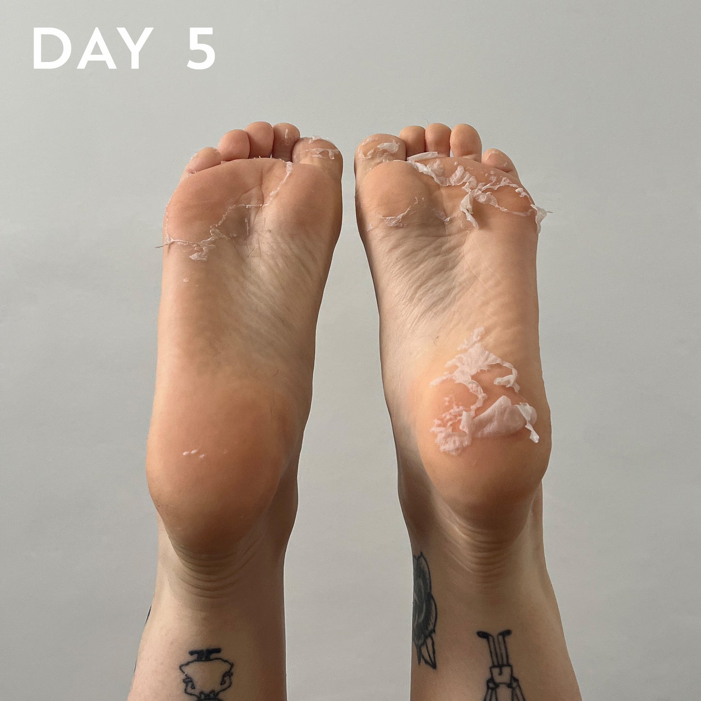 +maskology FOOT PEEL fótamaski