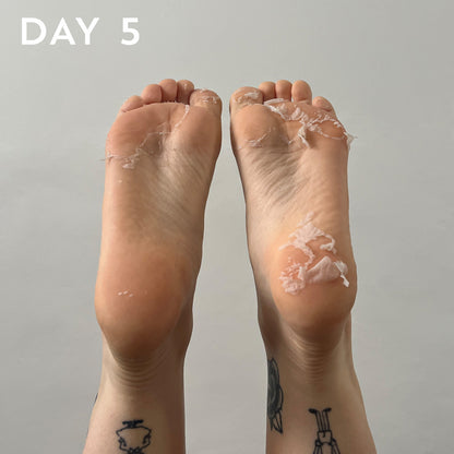 +maskology FOOT PEEL fótamaski