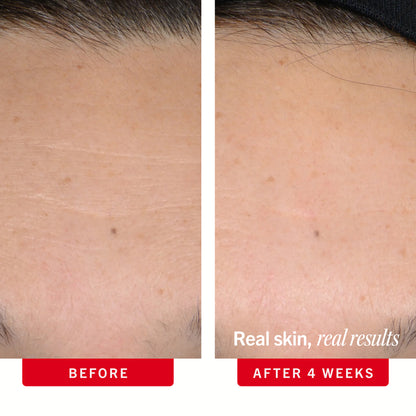 Before and after comparison of skin texture with text 'Real skin, real results' and 'After 4 weeks'.