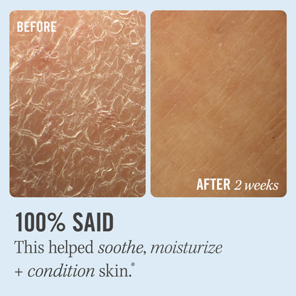Ultra Repair Cream (2 stærðir)