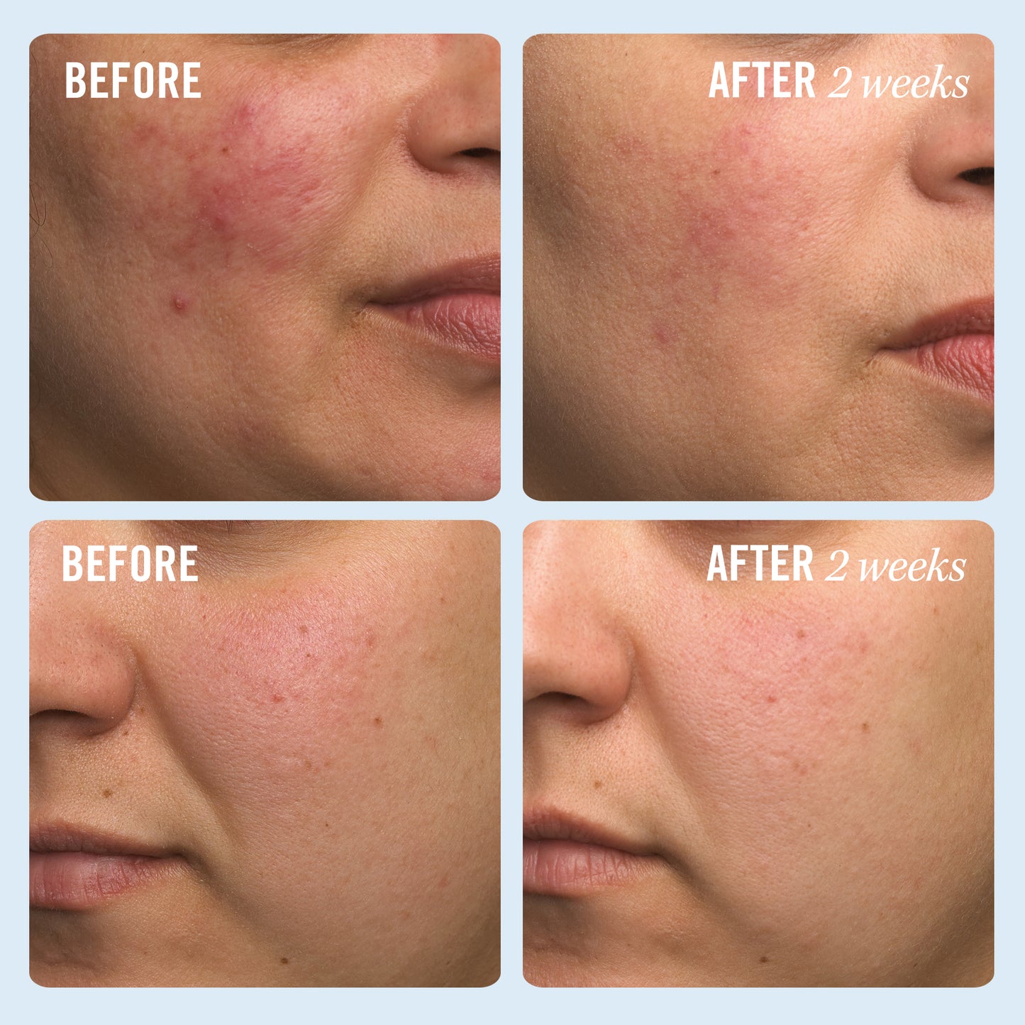 Ultra Repair Cream (2 stærðir)