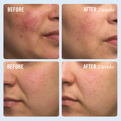 Ultra Repair Cream (2 stærðir)
