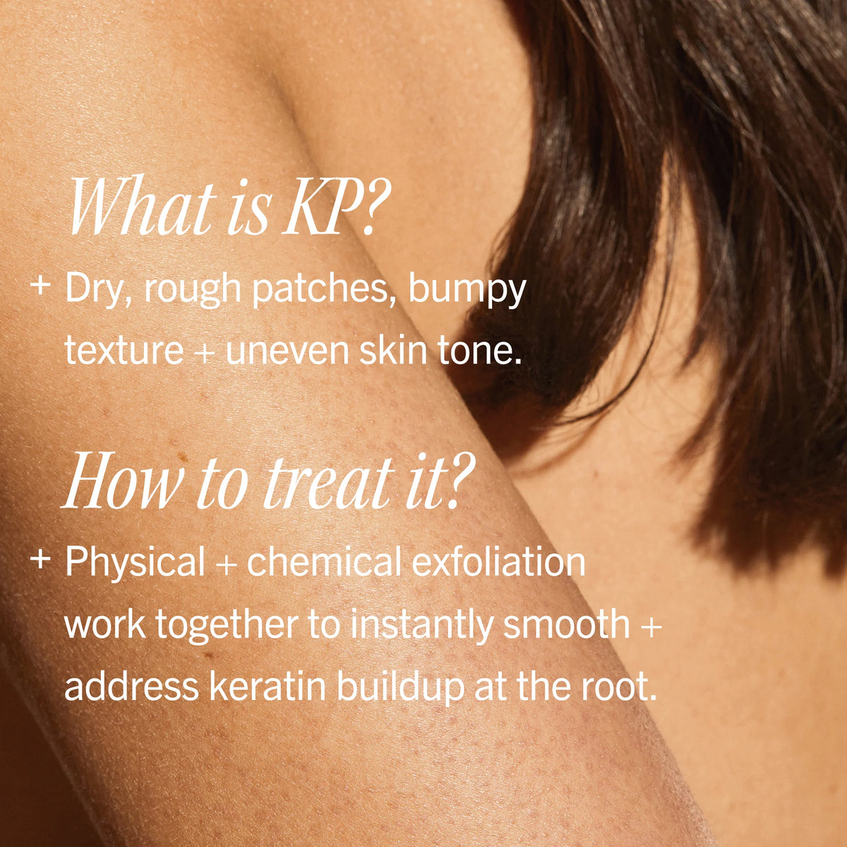 Text explaining KP (Keratosis Pilaris) and treatment methods on a person's arm.