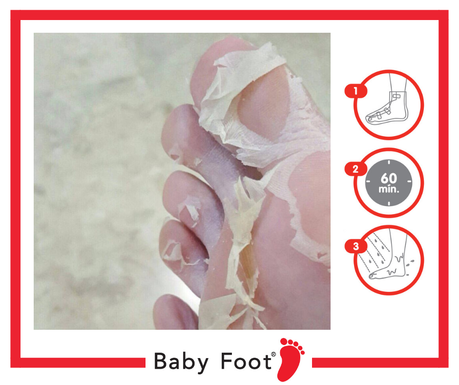 Baby Foot Peel Fótameðferð